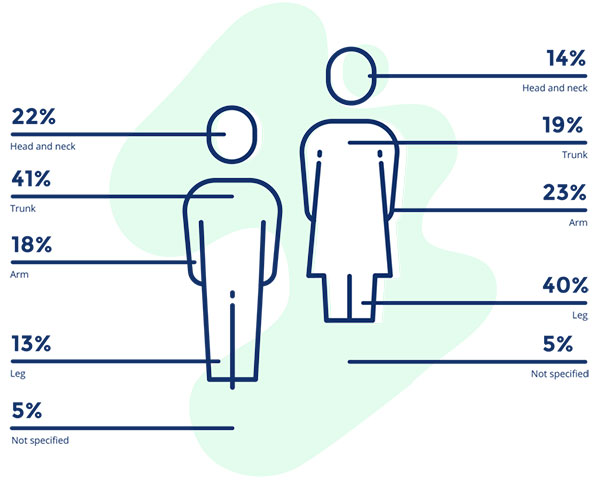 Skin Cancer Risk by Gender Image